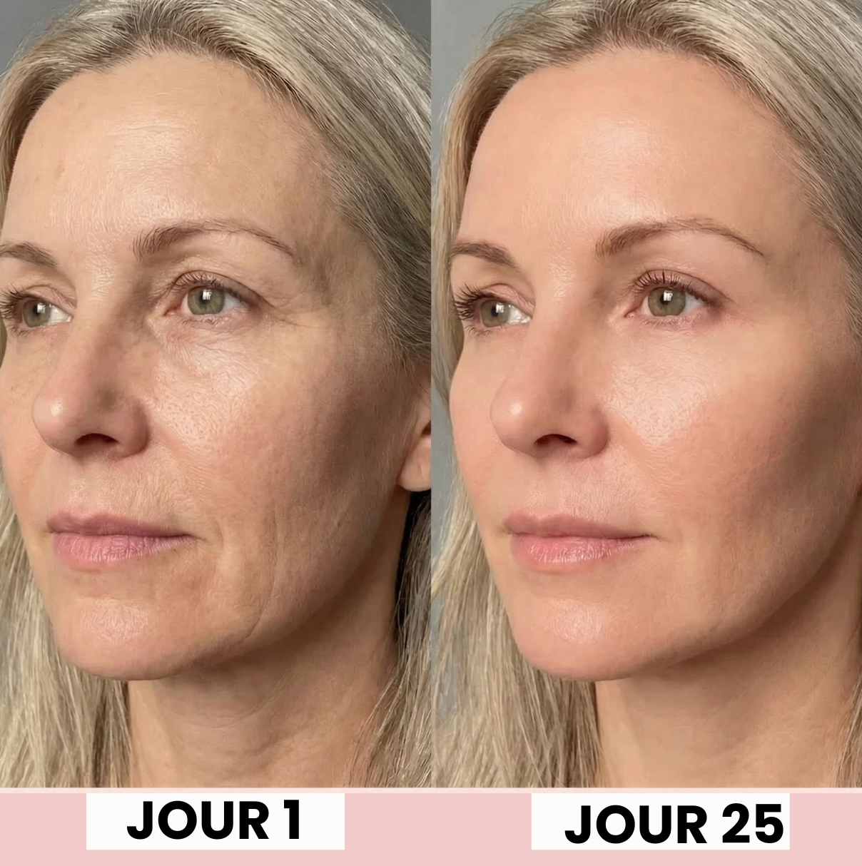 SKINYLISS massage facial anti-âge