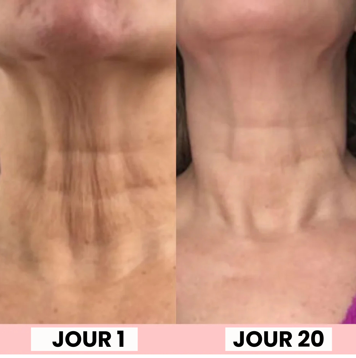 SKINYLISS massage facial anti-âge